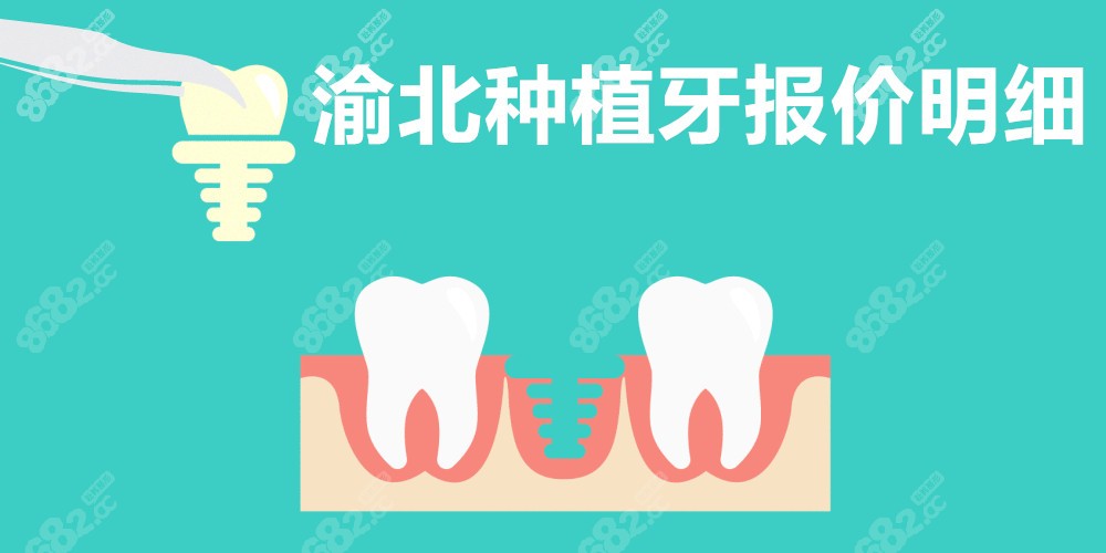 渝北种植牙报价明细