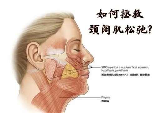 颈阔肌解剖图图片