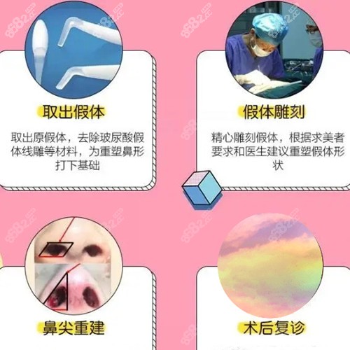 做耳软骨隆鼻修复手术原理图