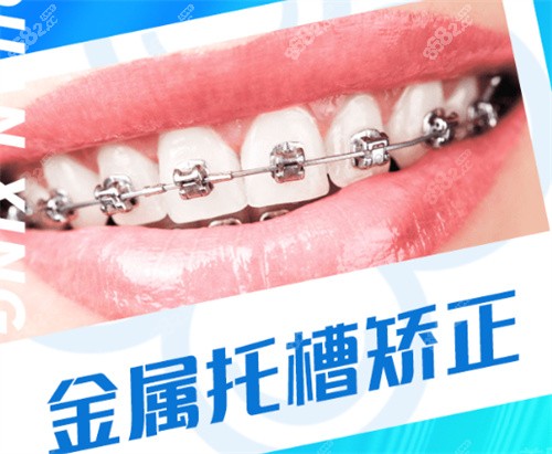 泉兴口腔金属托槽矫正
