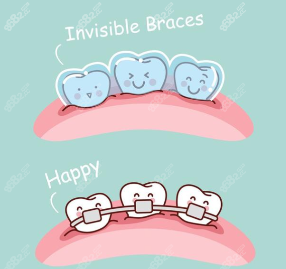 隐形矫正和金属矫正牙套的图片