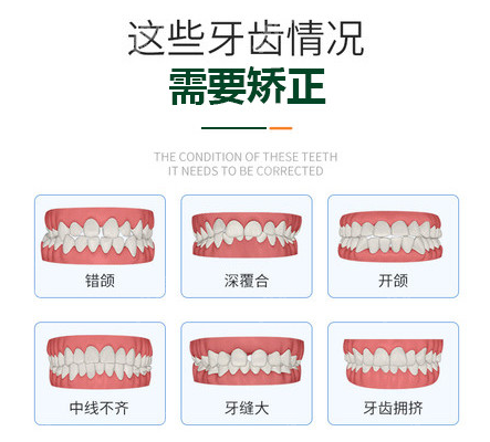 哪些牙齿适合做牙齿矫正