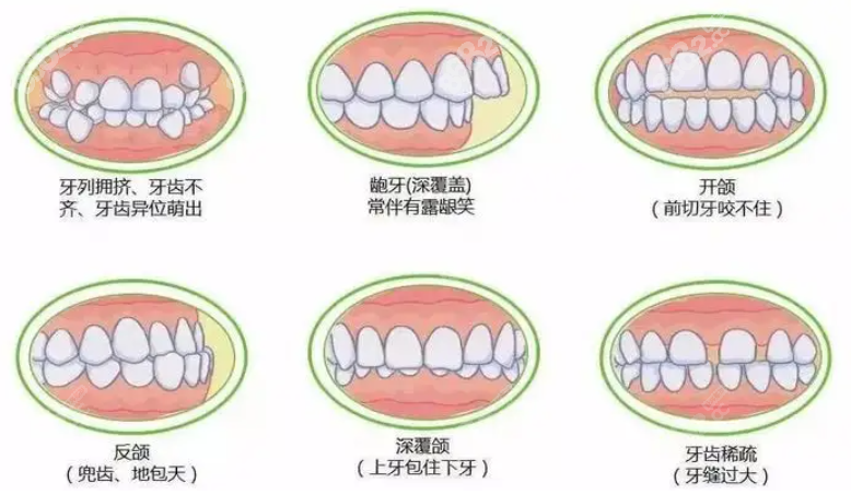 衡阳牙齿矫正好的医院