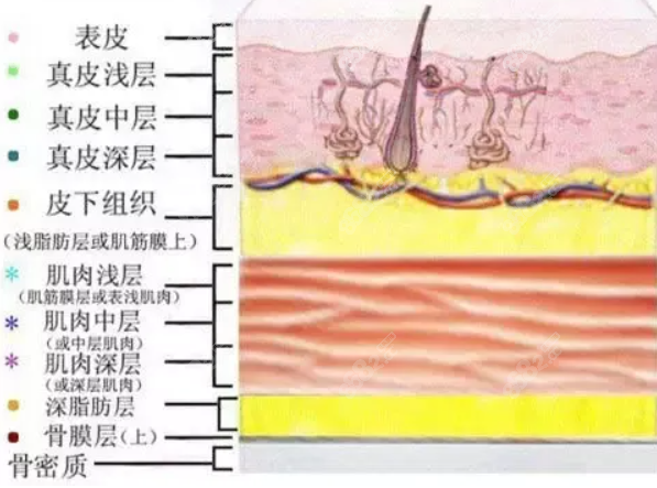 玻尿酸注射皮肤层次图示