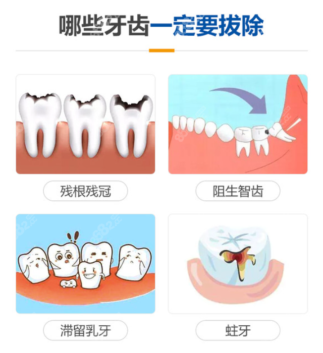 牙齿烂到只剩牙根需要拔吗