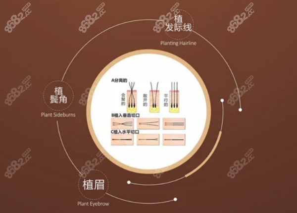 <!--<i data=20240705-sp></i>-->植发官网优惠