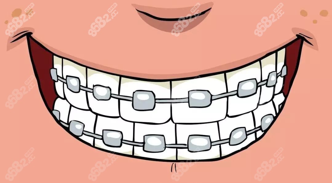 张词医生做金属、隐形牙齿矫正比较好