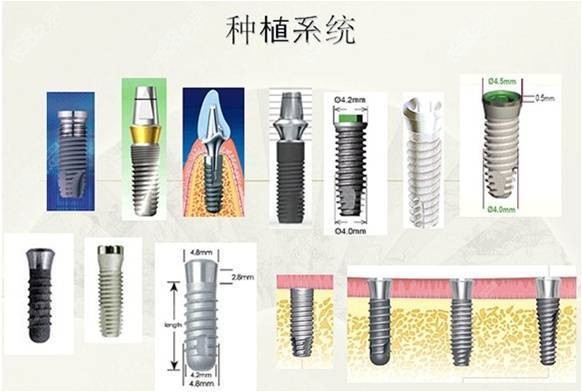 北京好牙美朝阳区双井店种植牙怎么样