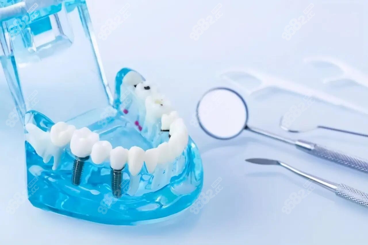 怎么看牙齿的咬合关系是否正常?-爱康健齿科