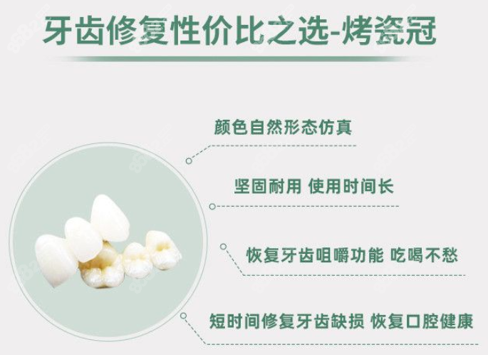 烤瓷牙在什么情况下必须拆除