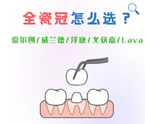 2022正规医院全瓷牙收费标准