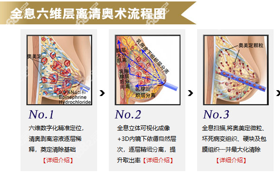 全息六维层离清奥技术流程图