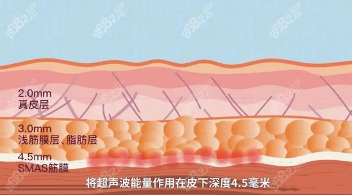 顾客做半岛超生炮全脸后的皮肤变化