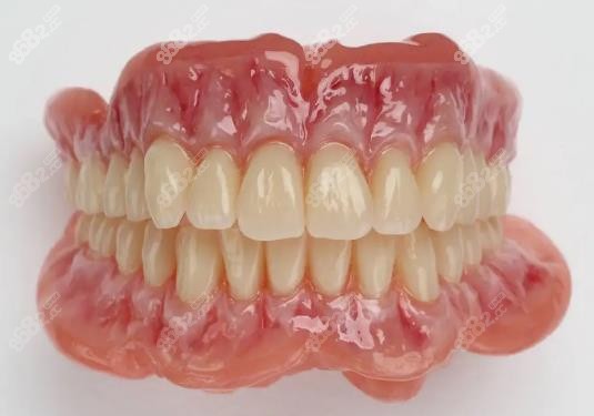 bps吸附性义齿优点 bps吸附性义齿优点