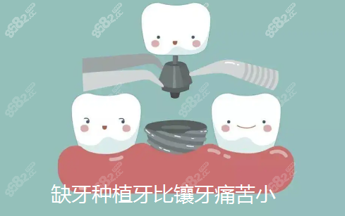 缺牙除了种植还有更好的方法吗