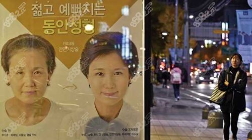 韩国面部提升手术对比图和费用介绍.jpg