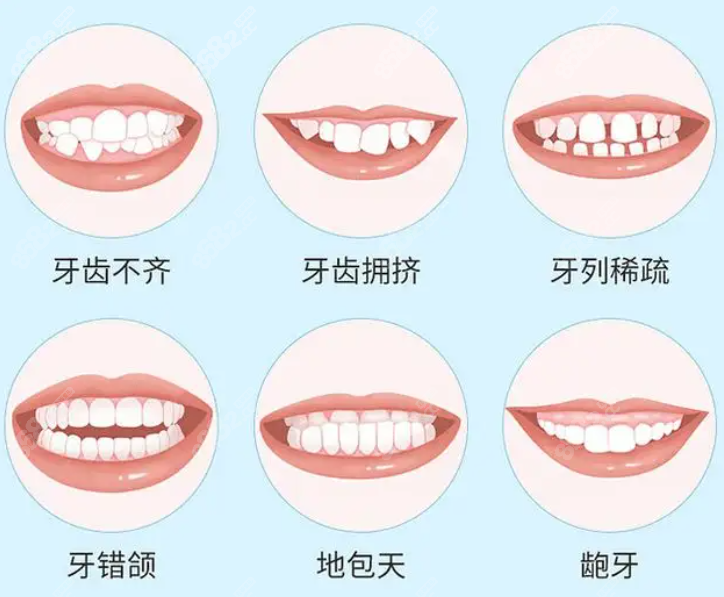 益阳满嘴牙矫正多少钱