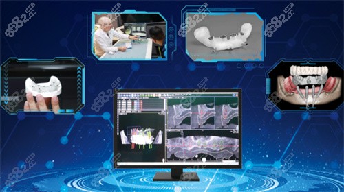 北京启康口腔数字化种牙 北京启康口腔数字化种牙