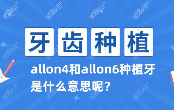 allon4和allon6种植牙是什么意思