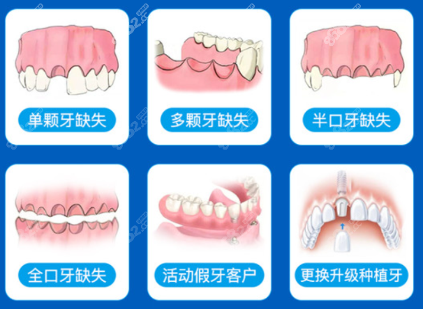 宁波恒美口腔种牙怎么样
