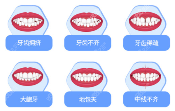 宁波恒美口腔做牙齿矫正好吗
