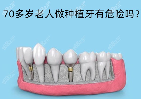 70多岁老人做种植牙有危险吗