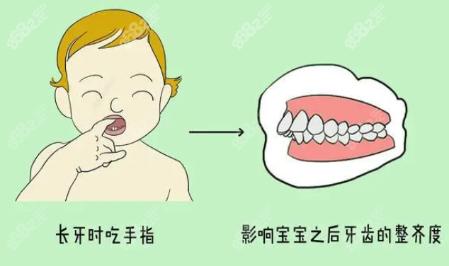 宁波恒美口腔儿童牙齿矫正多少钱