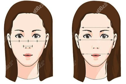 做完颧骨颧弓手术后悔了咋回事