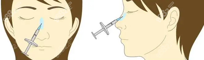 郑州注射隆鼻价格