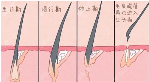 毛囊坏死的过程图解