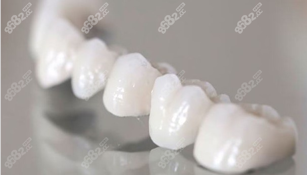 二氧化锆全瓷牙和普通全瓷牙哪个好