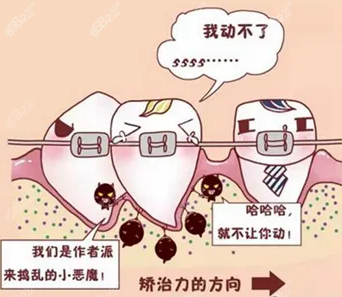 玉溪牙齿矫正价格表