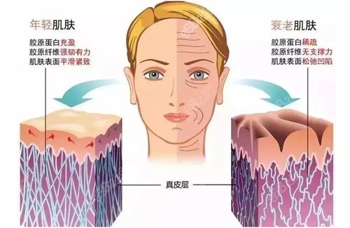 年轻肌肤与衰老肌肤对比