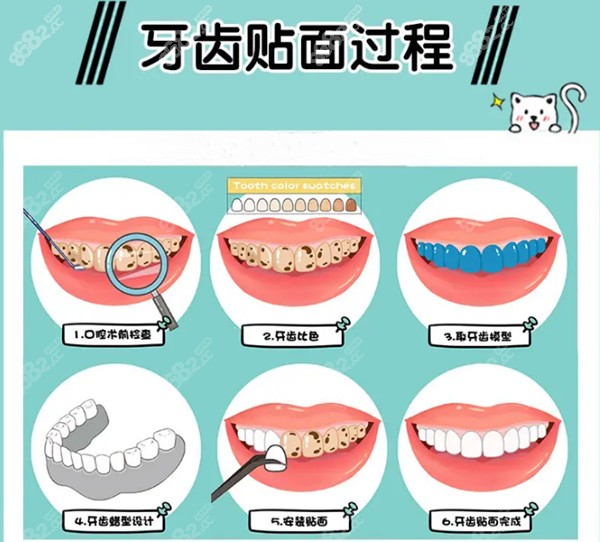 青岛牙齿贴面比较好的医院