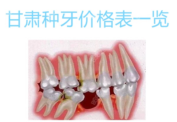 甘肃种牙价格表一览