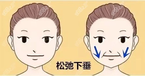 北京加減美面部提升
