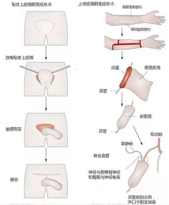 变性手术女性变男性m.8682.cc