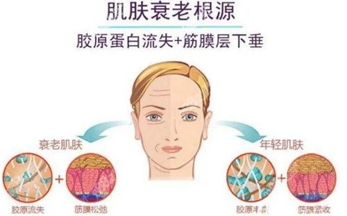 面部提升優(yōu)勢(shì)