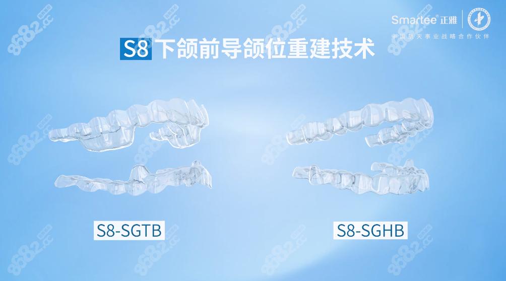 正雅s8颌位重建的价格在3万元起8682整形网
