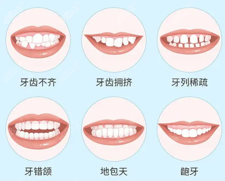 九江濂溪区牙齿矫正医院哪家好