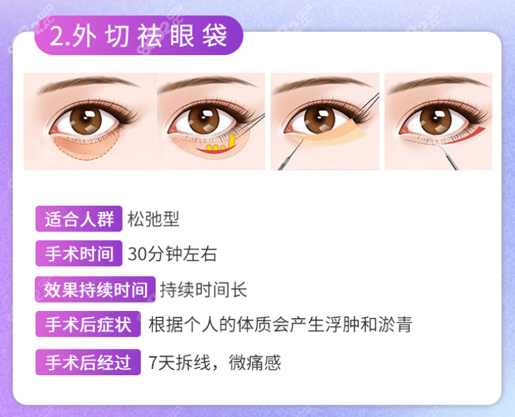 成都去眼袋哪家比較有實(shí)力