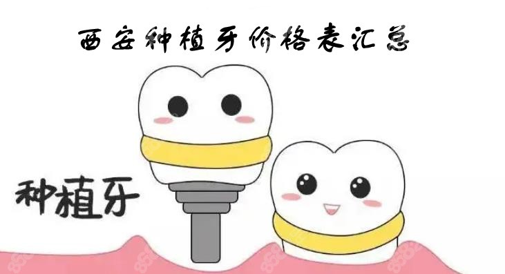 西安种植牙价格8682