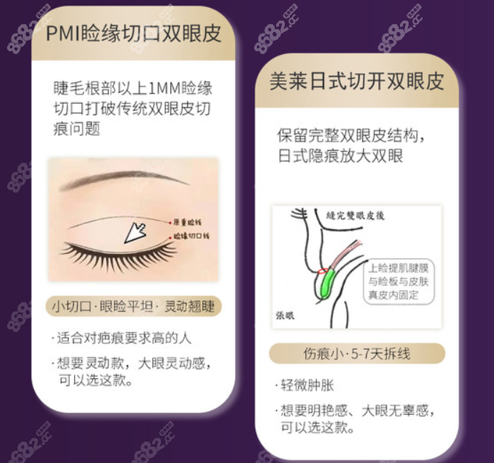 杭州美莱医院孟晨曦和徐刚医生做眼修复哪个好