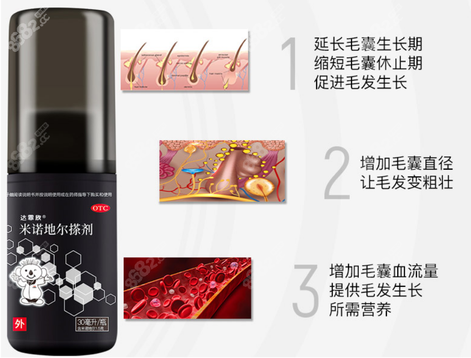 米诺地尔植发前用还是植发后用