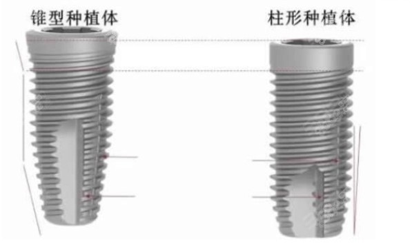韩国种植体和欧美种植体设计区别