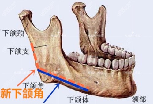 广州柳超磨骨