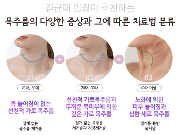 韩国延世多仁整形去颈纹的方式