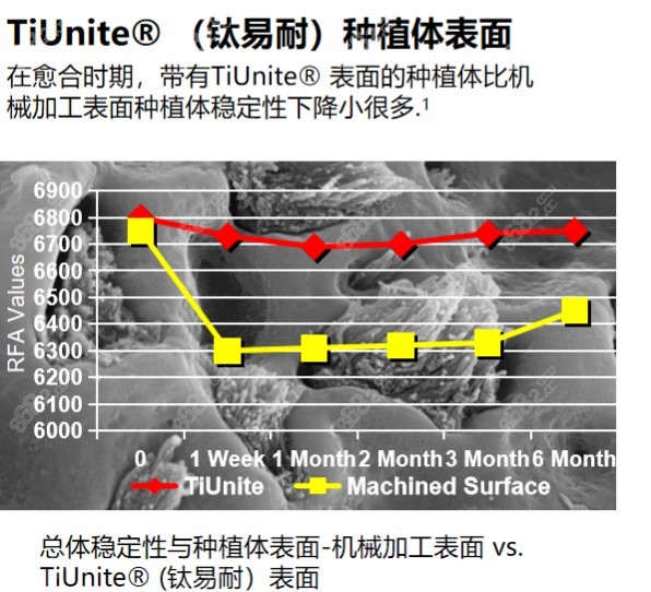 m.8682.cc介绍韩国和欧美种植牙的区别