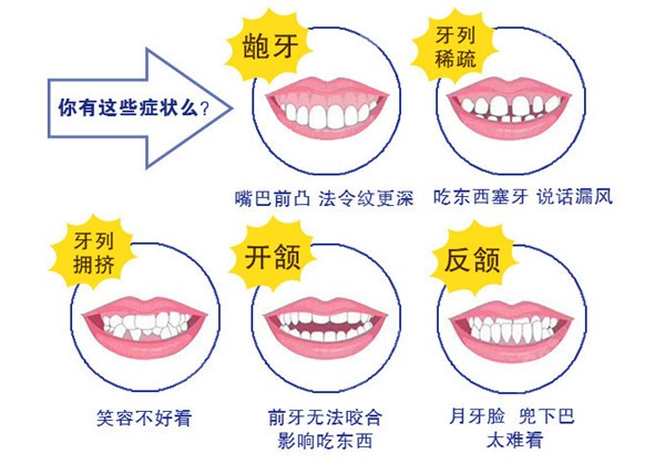 需要矫正牙齿畸形类型8682.cc