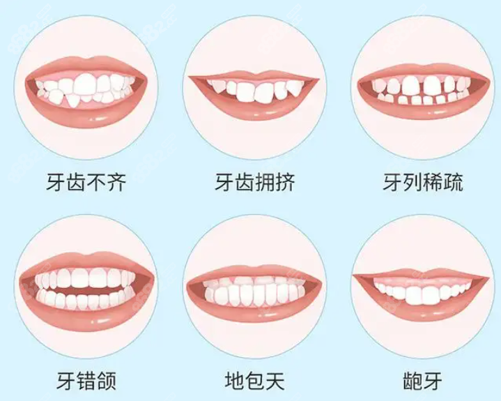 耒阳雅贝康矫正牙齿怎么样